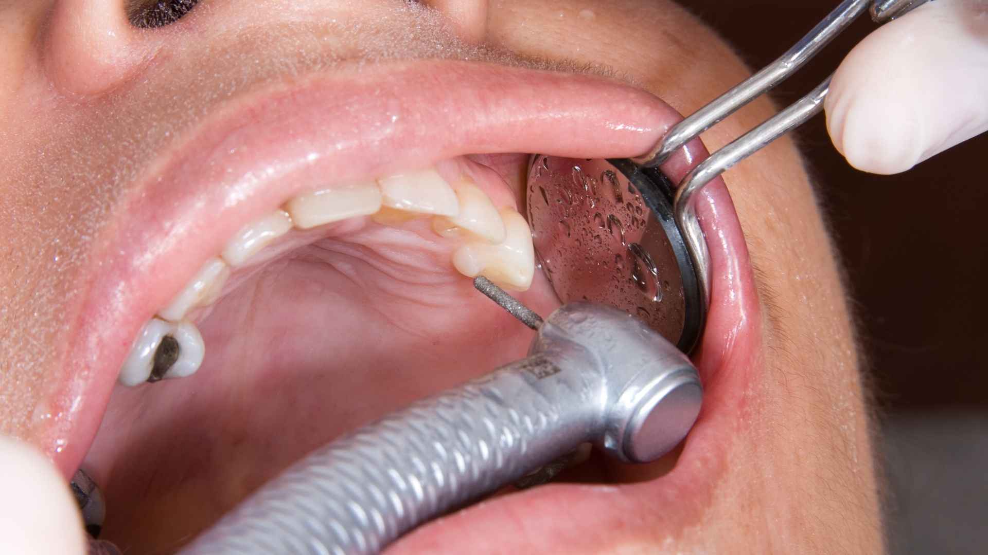 שיקום הפה וטיפולים אסתטיים