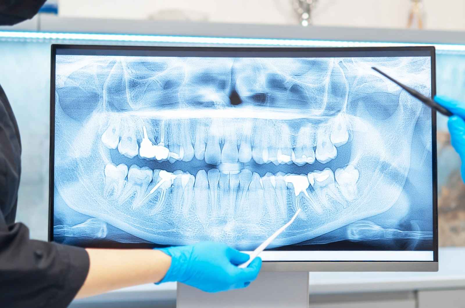 Mobile Dental CT Scans